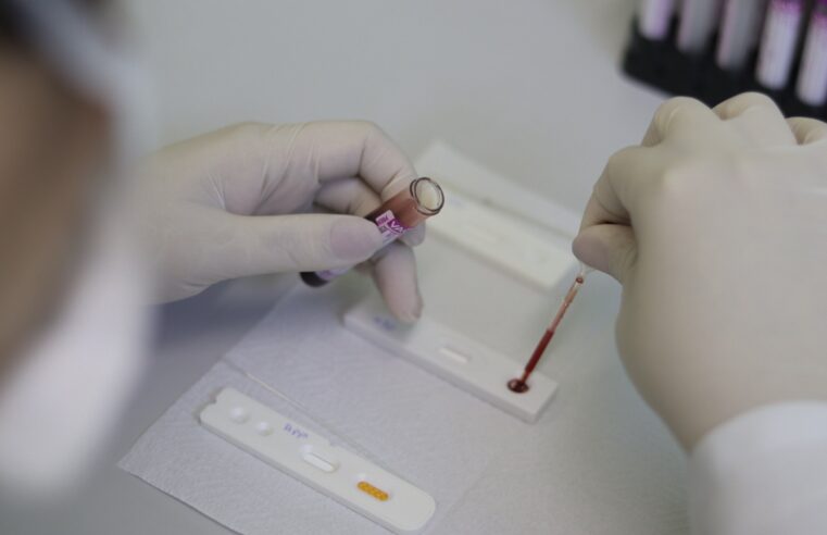 Campanha de prevenção às Infecções Sexualmente Transmissíveis chega às USFs neste mês