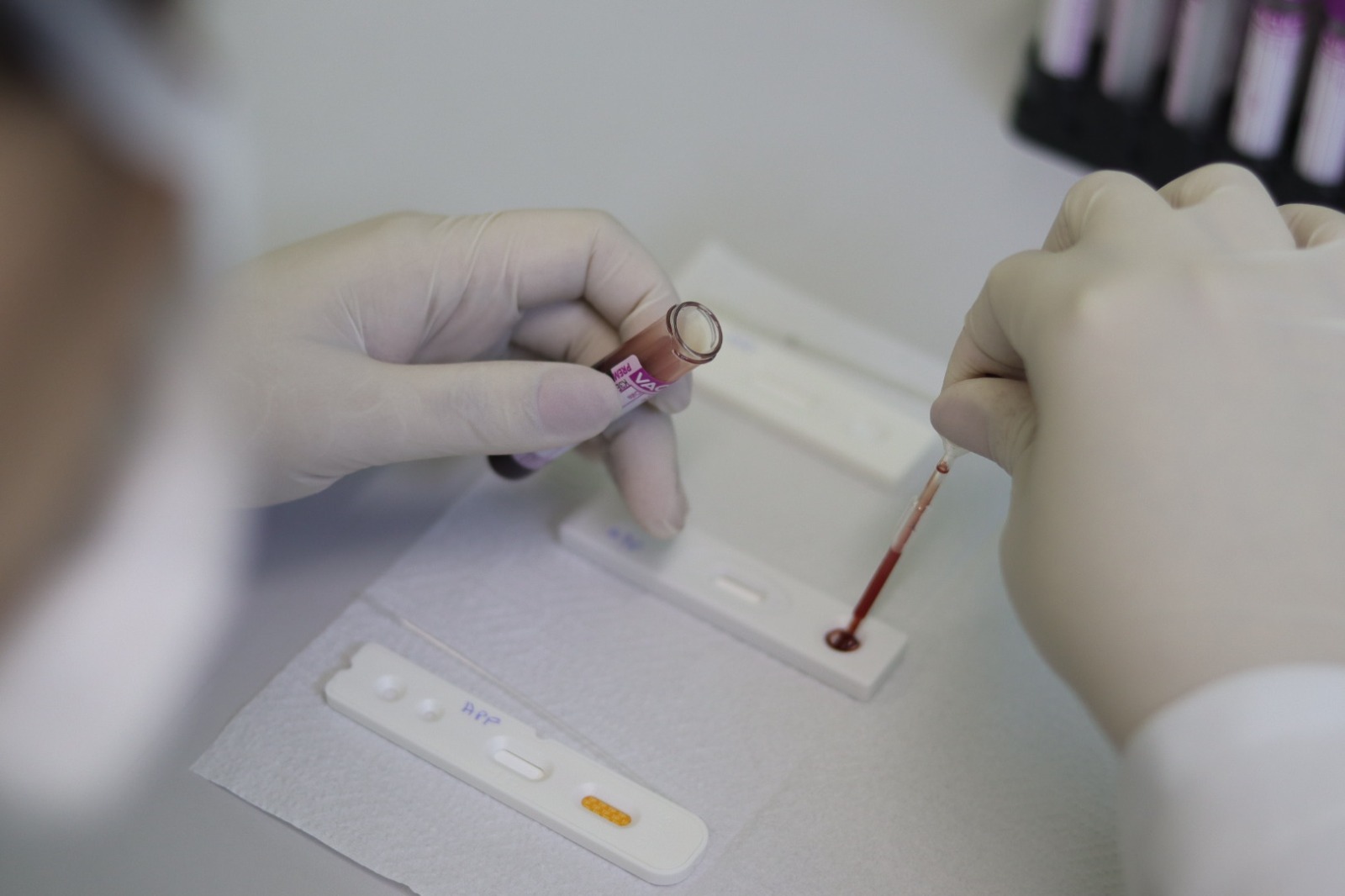 Campanha de prevenção às Infecções Sexualmente Transmissíveis chega às USFs neste mês
